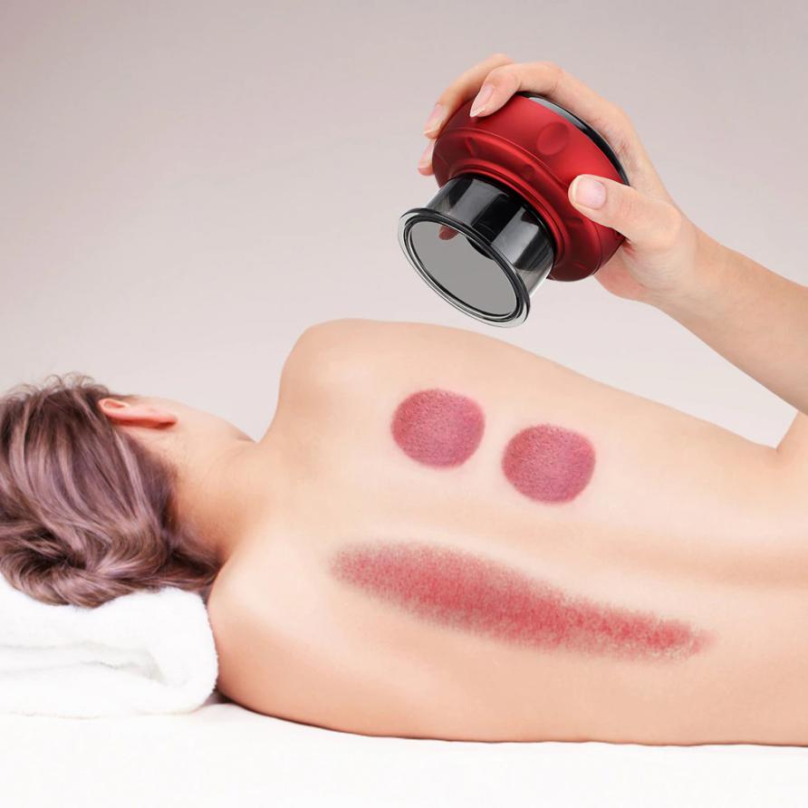 Electric Cupping Massager